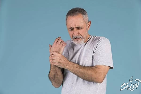 آرتریت روماتوئید از علل خواب رفتن دست و پا آرتریت روماتوئید